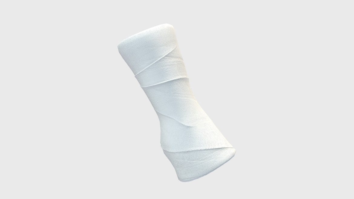 arm cast 3d model