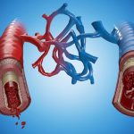 Medical view – Vein + Artery