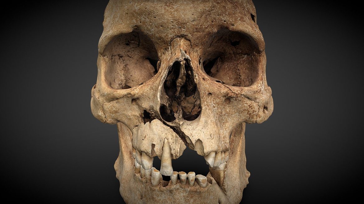 cranium with injuries 260727 3d model