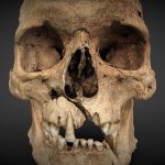 Cranium with injuries – 260727