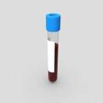 Blood Sample